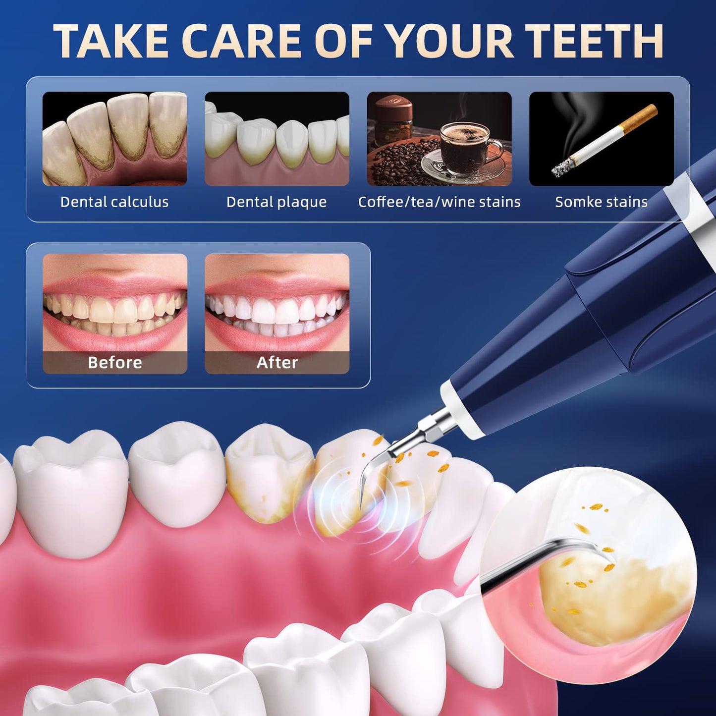 ELECTRIC DENTAL HYGIENE KIT FEATURING LED ILLUMINATION-HABANOVA™