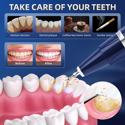 ELECTRIC DENTAL HYGIENE KIT FEATURING LED ILLUMINATION-HABANOVA™